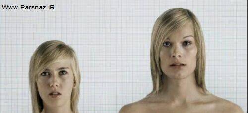 عکس هایی از قبل و بعد از عمل تغییر جنسیت عکس هایی از قبل و بعد از عمل تغییر جنسیت