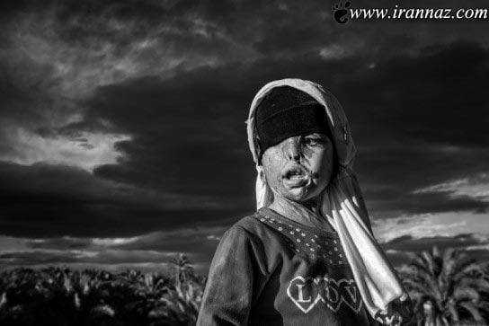 عکس های قربانیان عشق اجباری و جنون آمیز (16+)