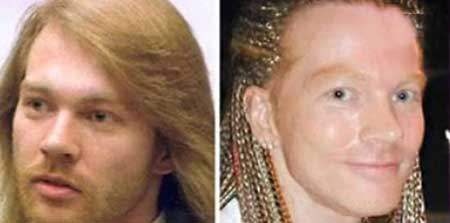 اخبار,اخبار فرهنگی , جراحی‌های زیبایی در میان هنرمندان