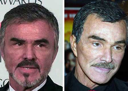 اخبار,اخبار فرهنگی , جراحی‌های زیبایی در میان هنرمندان