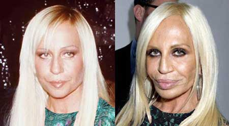 اخبار,اخبار فرهنگی , جراحی‌های زیبایی در میان هنرمندان