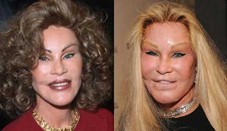 اخبار,اخبار فرهنگی , جراحی‌های زیبایی در میان هنرمندان