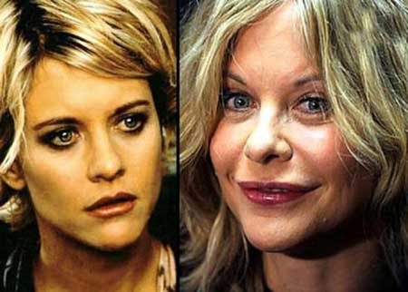 اخبار,اخبار فرهنگی , جراحی‌های زیبایی در میان هنرمندان