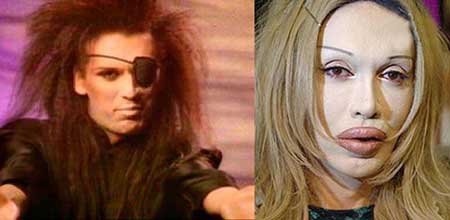 اخبار,اخبار فرهنگی , جراحی‌های زیبایی در میان هنرمندان