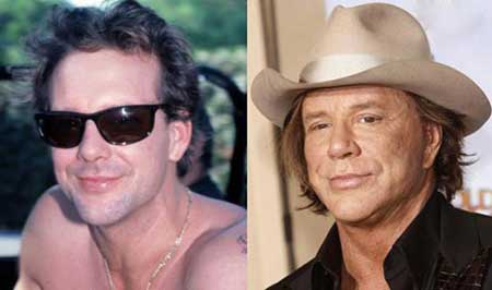 اخبار,اخبار فرهنگی , جراحی‌های زیبایی در میان هنرمندان