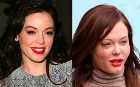 اخبار,اخبار فرهنگی , جراحی‌های زیبایی در میان هنرمندان