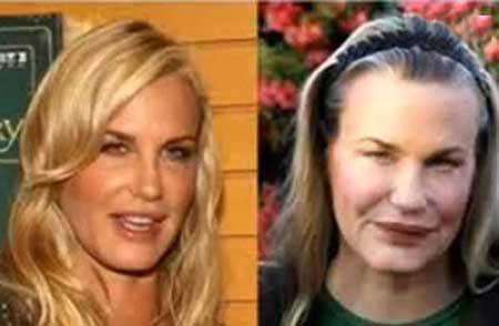 اخبار,اخبار فرهنگی , جراحی‌های زیبایی در میان هنرمندان